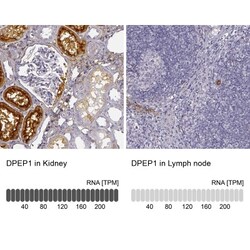 DPEP1 Antibody, Novus Biologicals 25 &mu;L; Unlabeled:Antibodies, Polyclonal